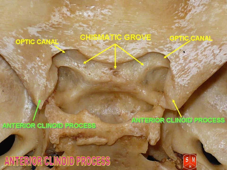 “Anterior Clinoid Process” – Anatomist90, via Wikimedia Commons. Licensed under CC BY-SA 3.0.