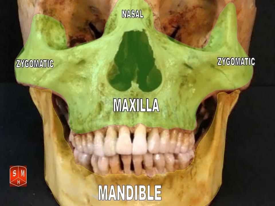 “Maxilla ” – Anatomist90, via Wikimedia Commons. Licensed under CC BY-SA 3.0