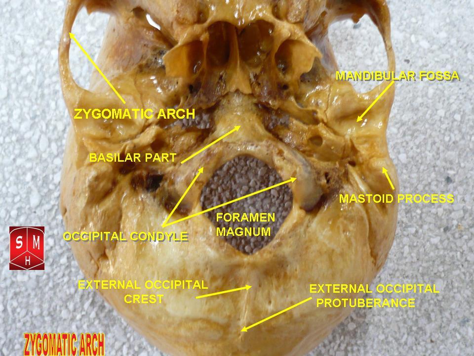 "Anatomical preparation"-Anatomist90, via Wikemeida Commons. Licensed under CC BY-SA3.0