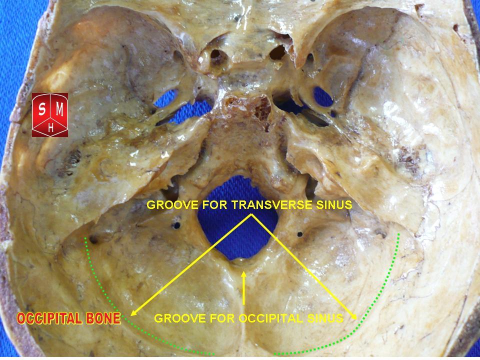Occipital bone (internal surface with venous sinus grooves)” – Anatomist90. own work, via Wikimedia Commons. Licensed under CC BY-SA 3.0.