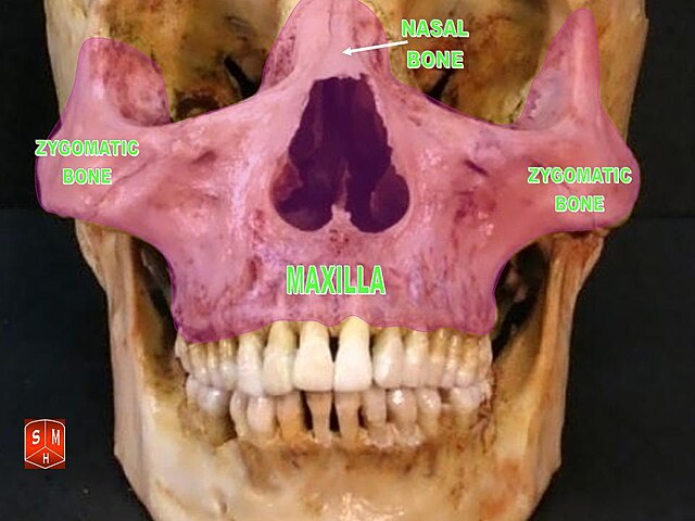 “Maxilla (anterior view)” – Anatomist90, via Wikimedia Commons. Licensed under CC BY-SA 3.0