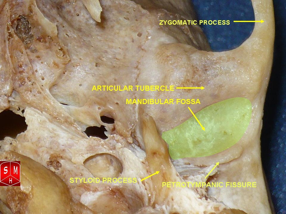 "Mandibular Fossa” – Anatomist90, via Wikimedia Commons. Licensed under CC BY-SA 3.0.