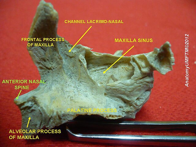 Anatomical dissections” – Anatomist90, via Wikimedia Commons. Licensed under CC BY-SA 3.0