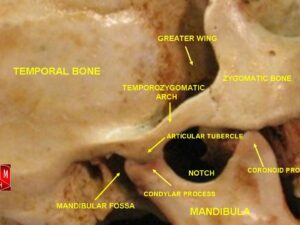 “Temporomandibular Joint” – Anatomist90, via Wikimedia Commons. Licensed under CC BY-SA 3.0