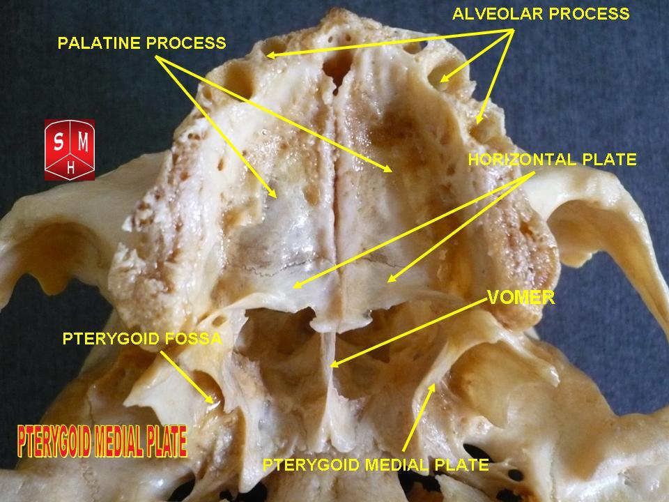 Pterygoid Medial Plate (Anatomical Preparation)” – Anatomist90, via Wikimedia Commons. Licensed under CC BY-SA 3.0