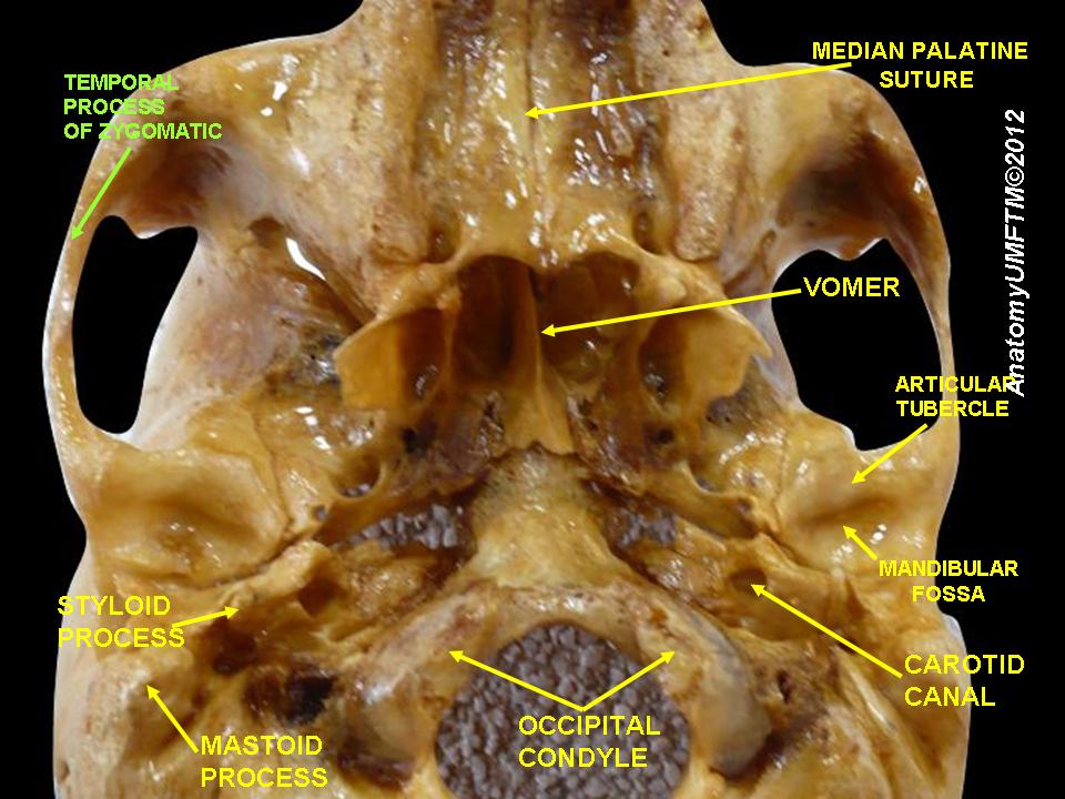 “Slide10qqq.JPG (Anatomical dissections)” – Anatomist90, via Wikimedia Commons. Licensed under CC BY-SA 3.0