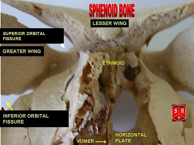 “Sphenoid bone – anterior view” – Anatomist90. Own work, via Wikimedia Commons. Licensed under CC BY-SA 3.0.