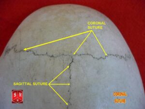 “Coronal suture (superior view of skull)” – Anatomist90, via Wikimedia Commons. Licensed under CC BY-SA 3.0.