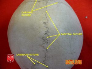 “Sagittal suture (superior view, labeled)” – Anatomist90, via Wikimedia Commons. Licensed under CC BY-SA 3.0.