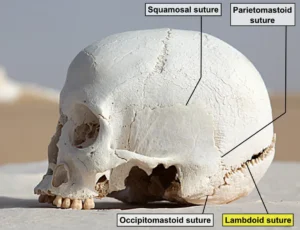 “Lambdoid suture – skull (lateral view)” – Roland Unger, via Wikimedia Commons. Licensed under CC BY-SA 3.0