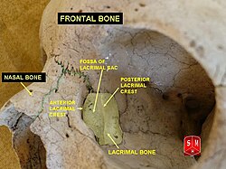 “Lacrimal and nasal bones” – Anatomist90, via Wikimedia Commons. Licensed under CC BY-SA 3.0.