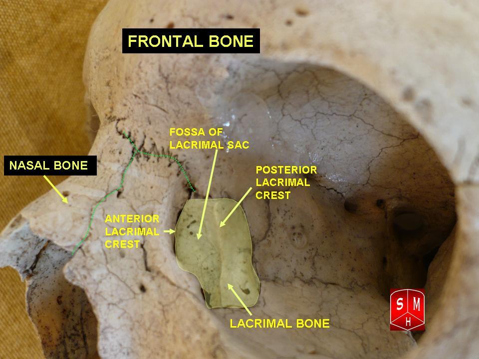 "Lacrimal and Nasal Bones"-Anatomist90, via Wikemeida Commons. Licensed under CC BY-SA3.0