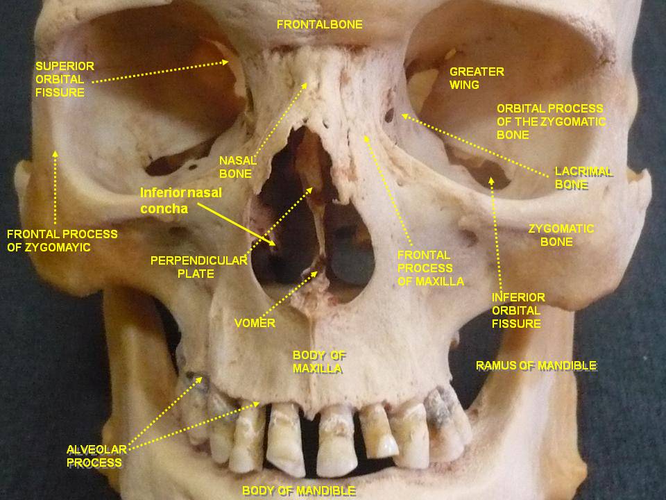 Anatomical dissection” – Anatomist90, via Wikimedia Commons. Licensed under CC BY-SA 4.0.