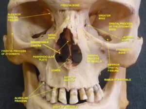 “Slide2hal (Anatomical dissection of skull, anterior view)” – Anatomist90, via Wikimedia Commons. Licensed under CC BY-SA 4.0.