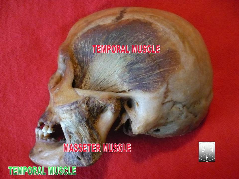 “Temporal muscle” – Anatomist90, via Wikimedia Commons. Licensed under CC BY-SA 3.0.