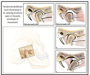 TMJ movements seen in Posselt’s envelope of movement” – Rjmedink, via Wikimedia Commons. Licensed under CC BY-SA 4.0.