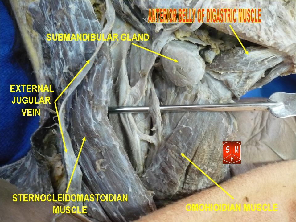 “Anterior Belly of Digastric Muscle” – Anatomist90 via  Wikimedia Commons. Licensed under CC BY-SA 3.0.