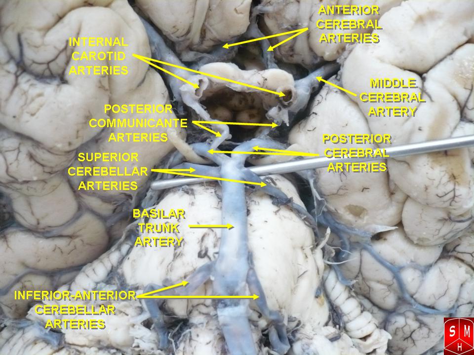 Circle of Willis – Anatomist90 via Wikimedia Commons. Licensed under CC BY-SA 3.0.