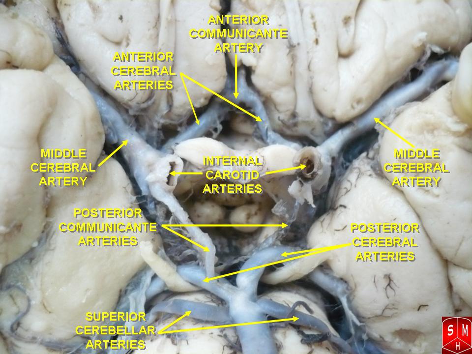 Circle of Willis – Anatomist90 via Wikimedia Commons. Licensed under CC BY-SA 3.0.