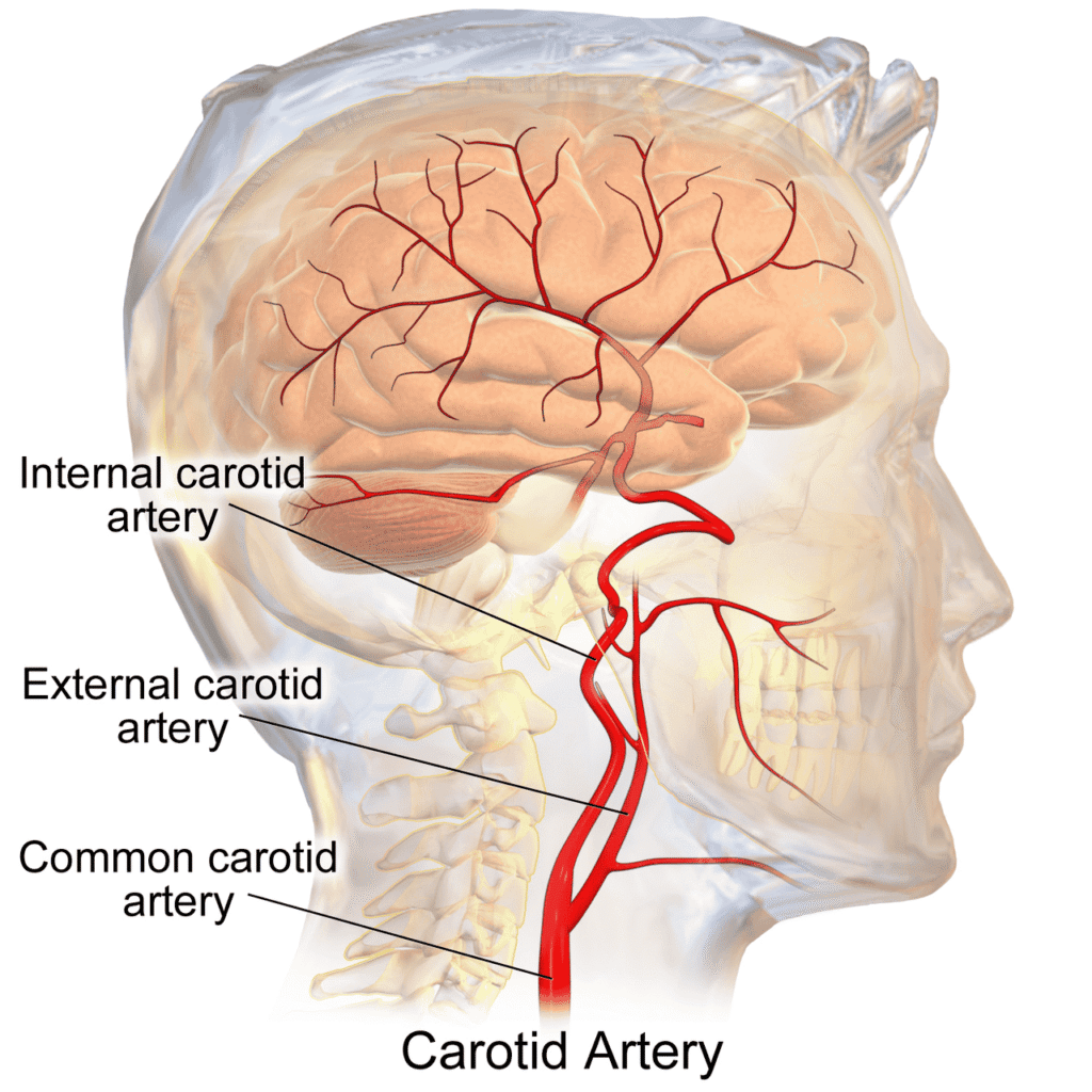 “Carotid Arteries” – BruceBlaus via Wikimedia Commons. Licensed under CC BY 3.0.