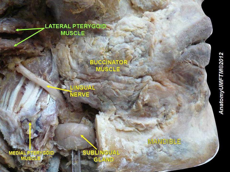 “Buccinator Muscle Dissection” – Anatomist90 via Wikimedia Commons. Licensed under CC BY-SA 3.0.