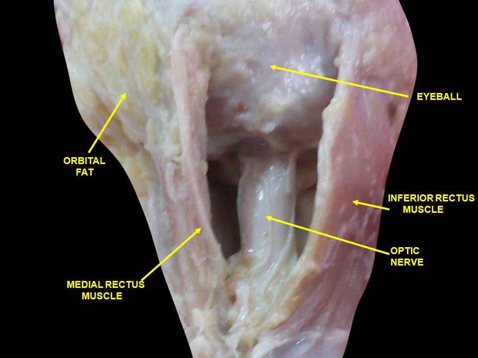 “Anatomical dissections” – Anatomist90 via  Wikimedia Commons. Licensed under CC BY-SA 3.0.