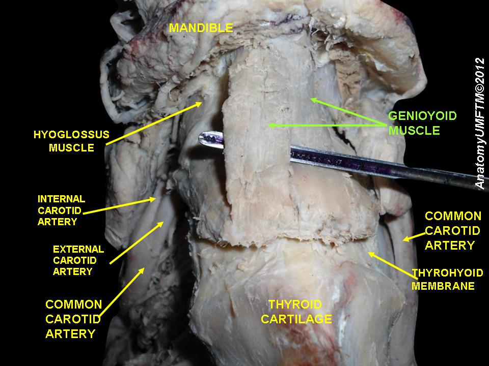 “Anatomical Dissections ” – Anatomist90, via Wikimedia Commons. Licensed under CC BY-SA 3.0.