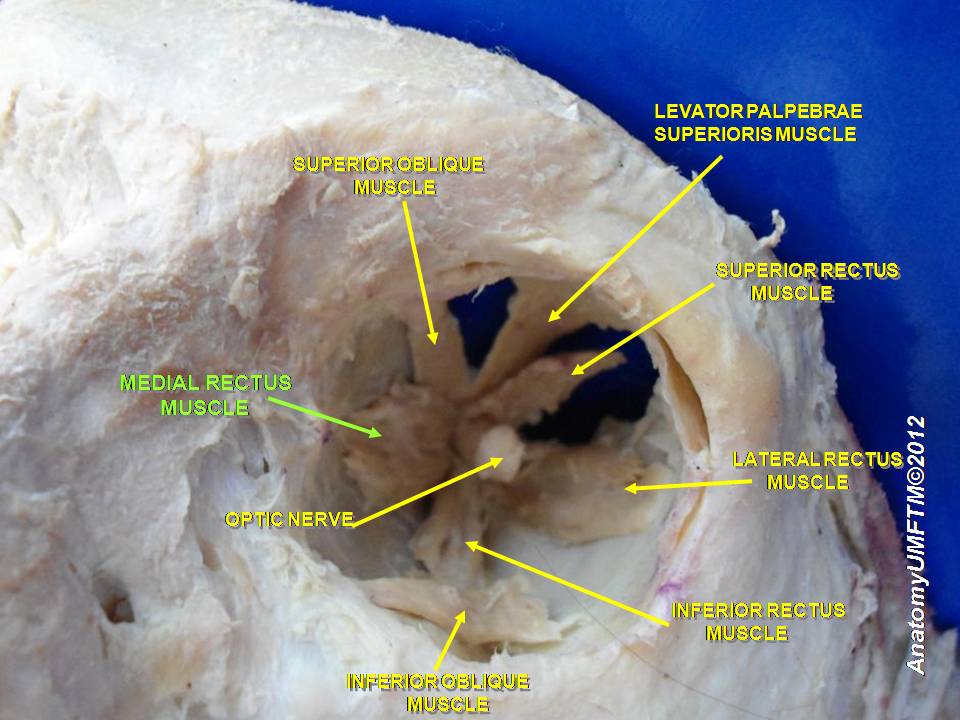 “Anatomical dissection” – Anatomist90 via Wikimedia Commons. Licensed under CC BY-SA 3.0.