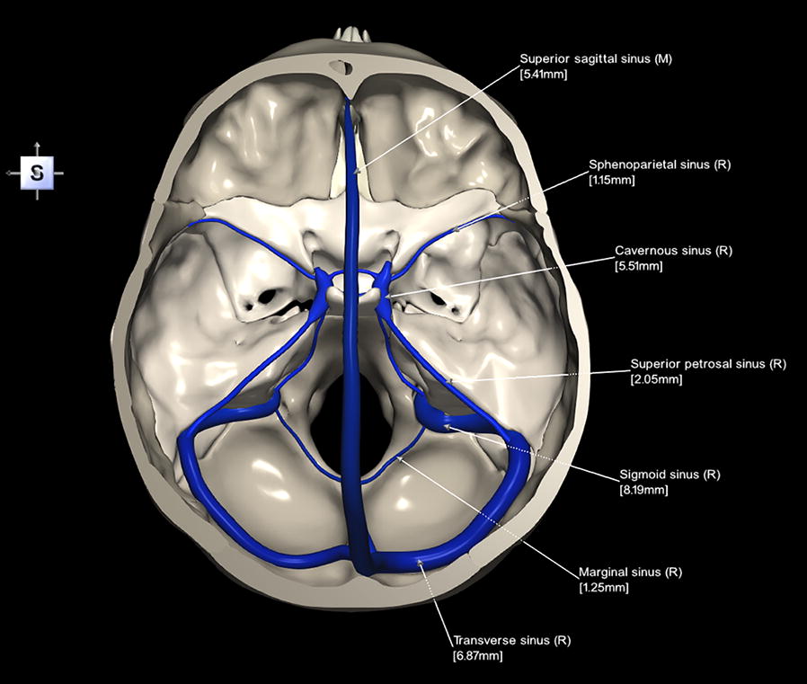 Source: Nowinski WL, Thaung TSL. Skull base with the dural sinuses labeled. Brain Informatics. 2018;5:1. Via Wikimedia Commons. Licensed under CC BY 4.0.